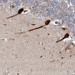 Invitrogen USF3 Polyclonal Antibody 100 &mu;L | Buy Online | Invitrogen&trade; | Fisher Scientific