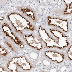 Invitrogen TMEM63B Polyclonal Antibody 100 &mu;L; Unconjugated:Antibodies,