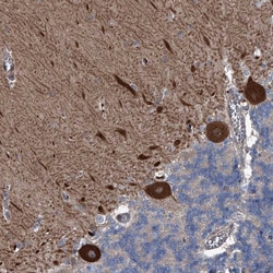 Invitrogen KIF13A Polyclonal Antibody 100 μL; Unconjugated:Antibodies,
