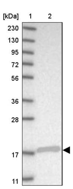 Invitrogen SRP19 Polyclonal Antibody 100 &mu;L | Buy Online | Invitrogen&trade; | Fisher Scientific