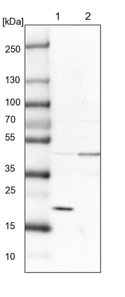 Invitrogen SRP19 Polyclonal Antibody 100 &mu;L | Buy Online | Invitrogen&trade; | Fisher Scientific