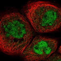 Invitrogen SPT5 Polyclonal Antibody 100 &mu;L; Unconjugated:Antibodies,
