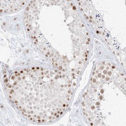 Invitrogen SPT5 Polyclonal Antibody 100 &mu;L; Unconjugated:Antibodies,