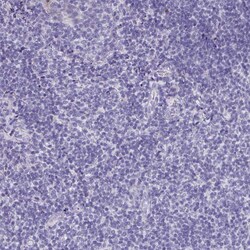 Invitrogen KIAA1751 Polyclonal Antibody 100 &mu;L; Unconjugated:Antibodies,