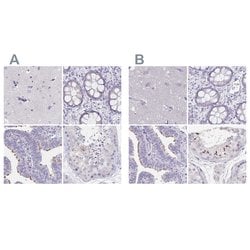 Invitrogen KIAA1751 Polyclonal Antibody 100 &mu;L; Unconjugated:Antibodies,
