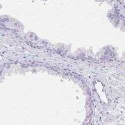 Invitrogen KIAA1751 Polyclonal Antibody 100 &mu;L; Unconjugated:Antibodies,