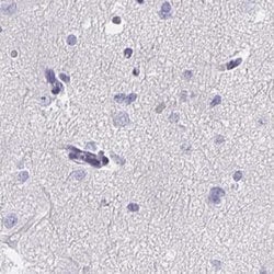 Invitrogen KIAA1751 Polyclonal Antibody 100 &mu;L; Unconjugated:Antibodies,