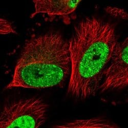 SIM2 Polyclonal Antibody, Invitrogen 100 &mu;L; Unconjugated:Antibodies,
