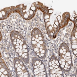 Invitrogen DMRT2 Polyclonal Antibody 100 &mu;L; Unconjugated:Antibodies,