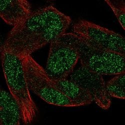 Invitrogen ZNF850 Polyclonal Antibody 100 &mu;L; Unconjugated:Antibodies,