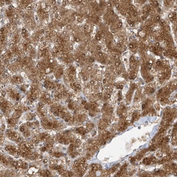 Invitrogen TTC38 Polyclonal Antibody 100 &mu;L | Buy Online | Invitrogen&trade; | Fisher Scientific