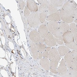 Invitrogen TTC38 Polyclonal Antibody 100 &mu;L | Buy Online | Invitrogen&trade; | Fisher Scientific