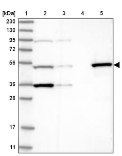 Invitrogen TTC38 Polyclonal Antibody 100 &mu;L | Buy Online | Invitrogen&trade; | Fisher Scientific