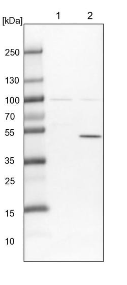 Invitrogen TTC38 Polyclonal Antibody 100 &mu;L | Buy Online | Invitrogen&trade; | Fisher Scientific
