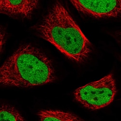 SNRNP200 Polyclonal Antibody:Antibodies, Polyclonal