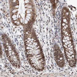 SNRNP200 Polyclonal Antibody:Antibodies, Polyclonal