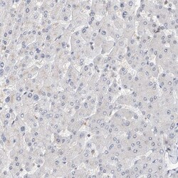 SNRNP200 Polyclonal Antibody:Antibodies, Polyclonal