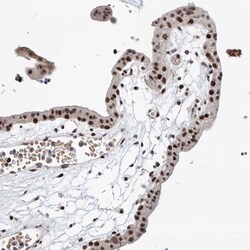 SNRNP200 Polyclonal Antibody:Antibodies, Polyclonal