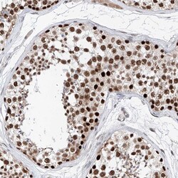SNRNP200 Polyclonal Antibody:Antibodies, Polyclonal
