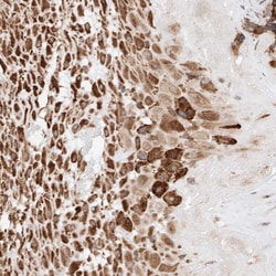 Invitrogen ATP9B Polyclonal Antibody 100 &mu;L | Buy Online | Invitrogen&trade; | Fisher Scientific