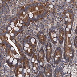 Invitrogen GAPVD1 Polyclonal Antibody 100 &mu;L | Buy Online | Invitrogen&trade; | Fisher Scientific