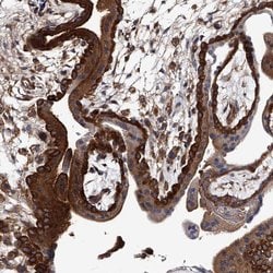 Invitrogen GAPVD1 Polyclonal Antibody 100 &mu;L; Unconjugated:Antibodies,
