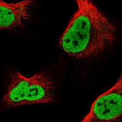 Invitrogen GLTSCR1L Polyclonal Antibody 100 &mu;L; Unconjugated:Antibodies,