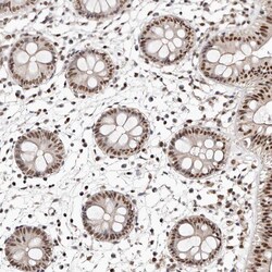 Invitrogen GLTSCR1L Polyclonal Antibody 100 &mu;L; Unconjugated:Antibodies,