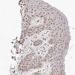 Invitrogen GLTSCR1L Polyclonal Antibody 100 &mu;L; Unconjugated:Antibodies,