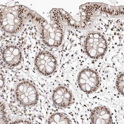 Invitrogen GLTSCR1L Polyclonal Antibody 100 &mu;L; Unconjugated:Antibodies,