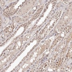 Invitrogen GLTSCR1L Polyclonal Antibody 100 &mu;L | Buy Online | Invitrogen&trade; | Fisher Scientific