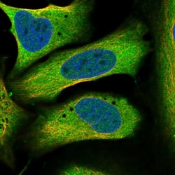 Invitrogen PIGX Polyclonal Antibody 100 &mu;L; Unconjugated:Antibodies,