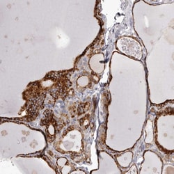 Invitrogen PIGX Polyclonal Antibody 100 &mu;L; Unconjugated:Antibodies,