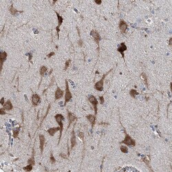 Invitrogen AGPAT9 Polyclonal Antibody 100 &mu;L; Unconjugated:Antibodies,