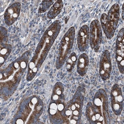 Invitrogen AGPAT9 Polyclonal Antibody 100 &mu;L; Unconjugated:Antibodies,