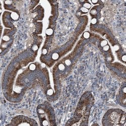 Invitrogen AGPAT9 Polyclonal Antibody 100 &mu;L; Unconjugated:Antibodies,