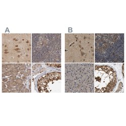 Invitrogen TCP-1 theta Polyclonal Antibody 100 &mu;L; Unconjugated:Antibodies,