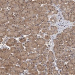 Invitrogen TCP-1 theta Polyclonal Antibody 100 &mu;L; Unconjugated:Antibodies,