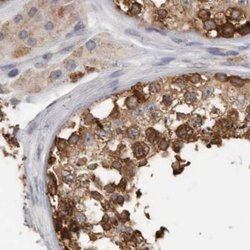 Invitrogen TCP-1 theta Polyclonal Antibody 100 &mu;L; Unconjugated:Antibodies,