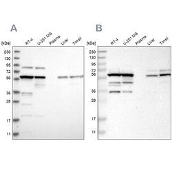 Invitrogen TCP-1 theta Polyclonal Antibody 100 &mu;L; Unconjugated:Antibodies,