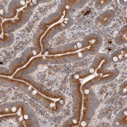 Invitrogen TMUB1 Polyclonal Antibody 100 &mu;L; Unconjugated:Antibodies,