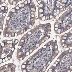 CHRNA3 Polyclonal Antibody, Invitrogen 100 &mu;L; Unconjugated:Antibodies,