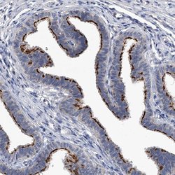 CHRNA3 Polyclonal Antibody, Invitrogen 100 &mu;L; Unconjugated:Antibodies,