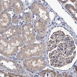 CHRNA3 Polyclonal Antibody, Invitrogen 100 &mu;L; Unconjugated:Antibodies,