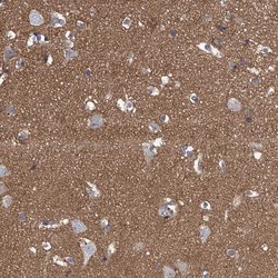 CHRNA3 Polyclonal Antibody, Invitrogen 100 &mu;L; Unconjugated:Antibodies,