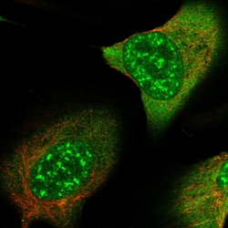 Invitrogen SMC4 Polyclonal Antibody 100 &mu;L; Unconjugated:Antibodies,