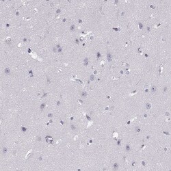 Invitrogen PRPH2 Polyclonal Antibody 100 &mu;L; Unconjugated:Antibodies,