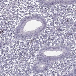 Invitrogen PRPH2 Polyclonal Antibody 100 &mu;L; Unconjugated:Antibodies,