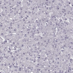 Invitrogen PRPH2 Polyclonal Antibody 100 &mu;L; Unconjugated:Antibodies,