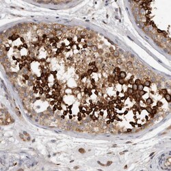 Invitrogen C7orf43 Polyclonal Antibody 100 &mu;L; Unconjugated:Antibodies,